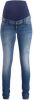 Noppies Skinny Jeans Avi Misty Blue 32/30 online kopen